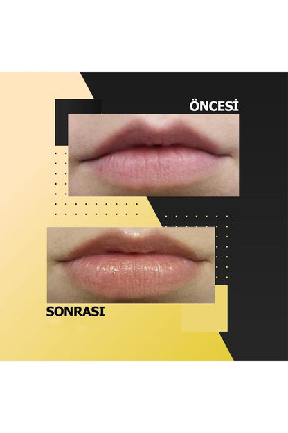 Too Be Beauty Antiaging &amp; Volumizer Lip Care 24 K Pure Gold Dudak Bakım Ürünü